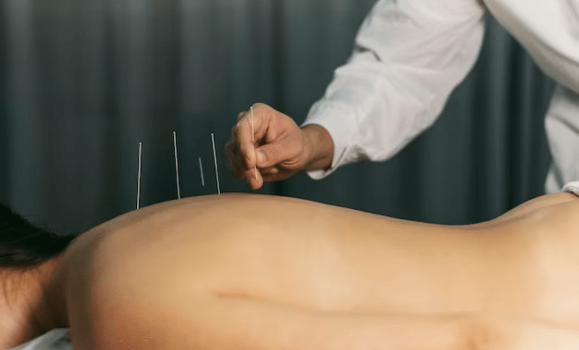 Science Behind Needles: Understanding How Acupuncture Works