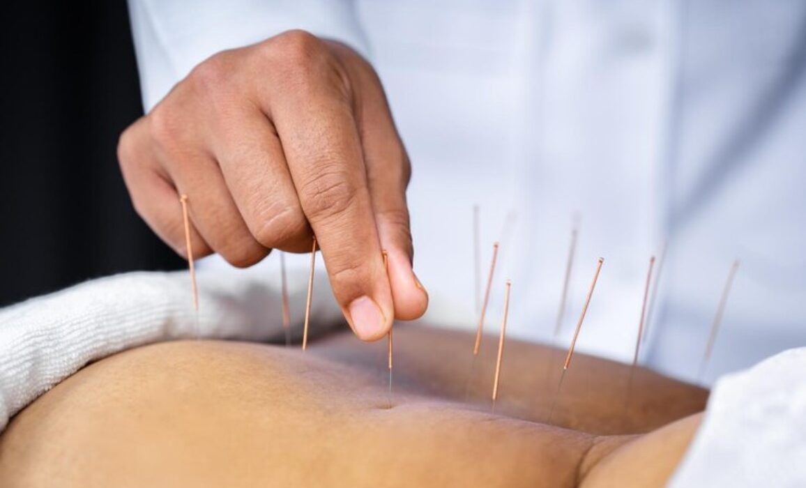 Acupuncture Disadvantages: Myth vs. Reality in Healthcare