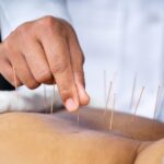 Acupuncture Disadvantages: Myth vs. Reality in Healthcare