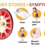 Kidney Stones Causes, Symptoms, and Homeopathy Treatment