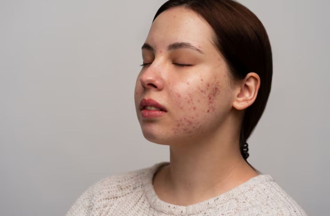 5 Symptoms of Hormonal Imbalance in Women